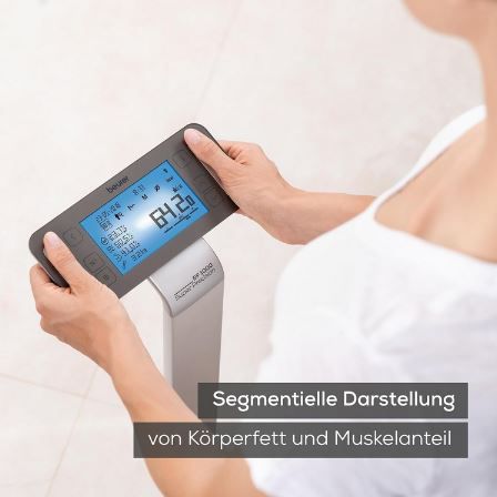 Beurer BF 1000 SuperPrecision Diagnosewaage mit App für 194,99€ (statt 251€)